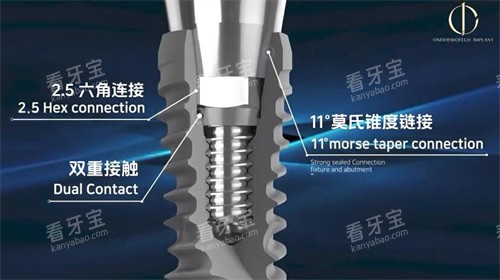 韩一种植牙材料展示照片 韩一种植牙材料展示照片