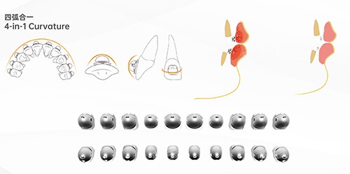 牙齿矫正OBrace球面全部托槽 牙齿矫正OBrace球面全部托槽
