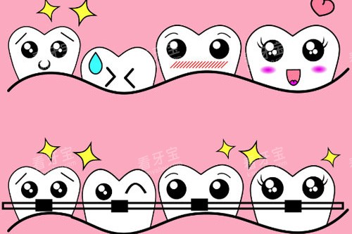 牙齿矫正反弹卡通图 牙齿矫正反弹卡通图