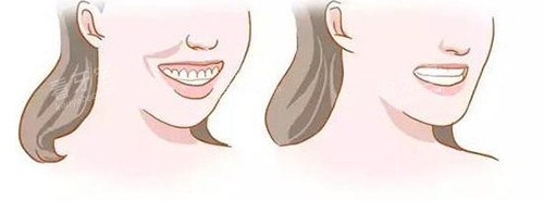 ���ݽ������ͱ仯�Ա�����ͼ