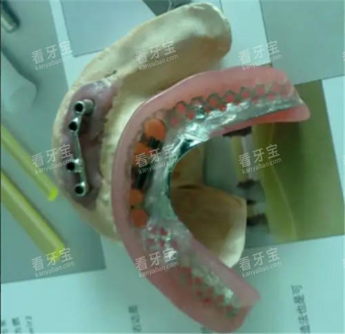 ��̶���ֲ��