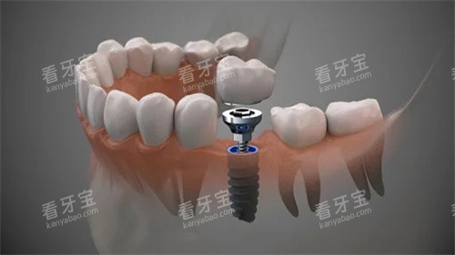 ��ֲ��͸�ӽṹͼ