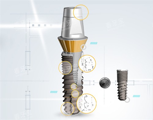 �人���ɿ�ǻ2026��ֲ���۸��������ICX��4500Ԫ�𣬱���/���ǵ�/Camlogȫϵ�б���͸������·��