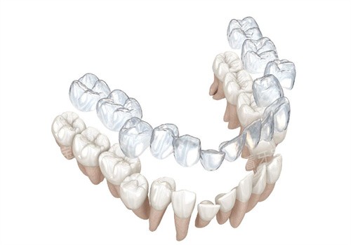 ���ν������ݹ���