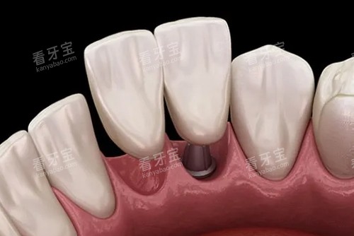 ��ֲ��һ�϶��ڲ�չʾͼ