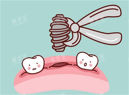 ���ݸ�������ʿ��ǻ��飿��������������ȫ��ԤԼ������ƺÿڱ�����