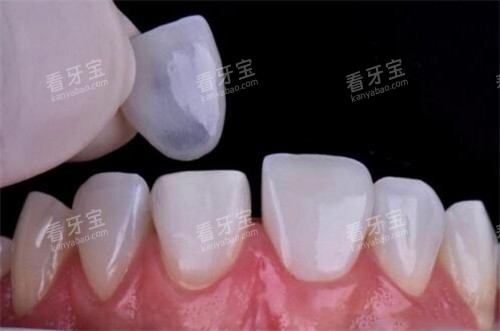 ���������޸�����ͼ