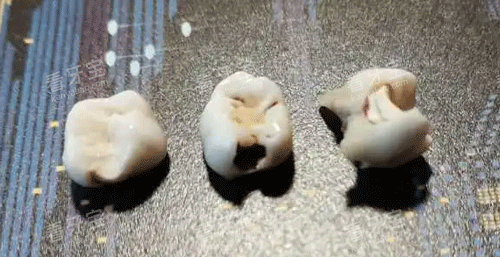 拔掉的坏牙 拔掉的坏牙