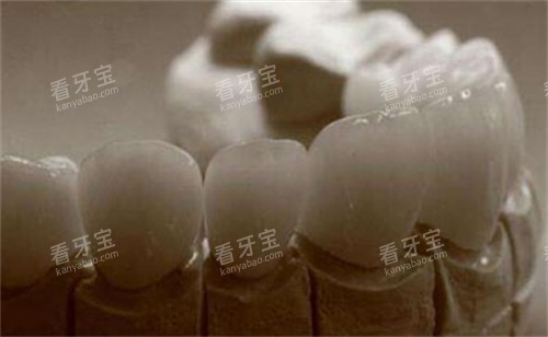 牙齿修复改善照片展示 牙齿修复改善照片展示