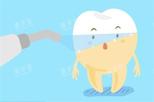 牙齿冷光美白示意图 牙齿冷光美白示意图