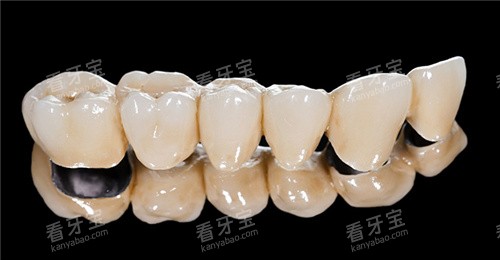 ����ɨ��û���ҧ��ӡ�ã��Ա���ȱ�㣬�����ҵ����ʺϵķ�ʽ��