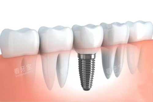 冠县张艳华口腔地址电话全公开!真实点评+价格参考,看牙不踩雷!