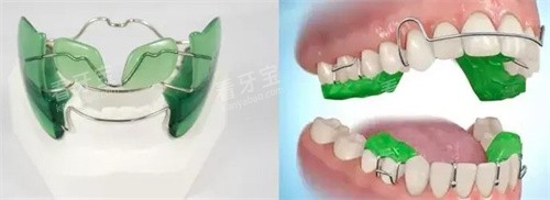 MRC如何佩戴 MRC如何佩戴