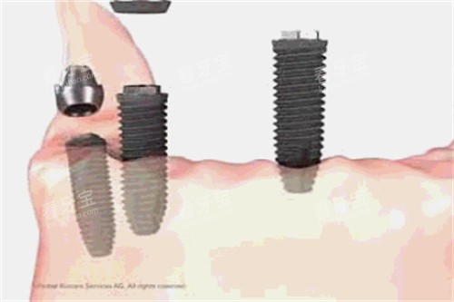 ��ֲ������ϸ��