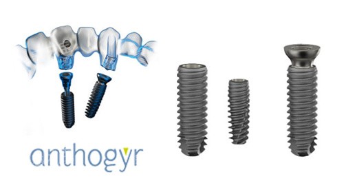 安卓健种植牙修复 安卓健种植牙修复