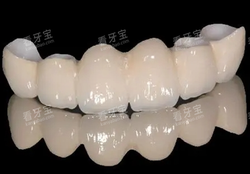 二氧化锆全瓷牙模型展示 二氧化锆全瓷牙模型展示