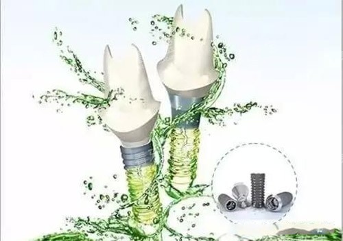 亲水性种植牙基台照片 亲水性种植牙基台照片