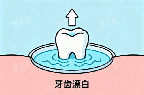 牙齿漂白卡通图 牙齿漂白卡通图