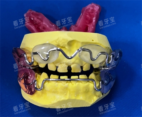 法兰克3功能矫正器 法兰克3功能矫正器