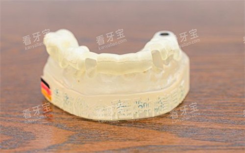 牙齿模具照片 牙齿模具照片