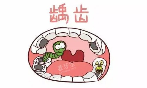 牙齿龋齿示意图 牙齿龋齿示意图