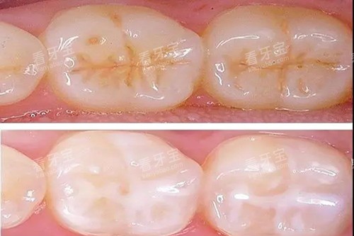 ������ǻҽԺ����:26�������Ͽɵ���ŵ����/С���õ�!