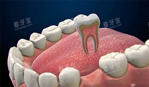 牙齿卡通图片 牙齿卡通图片