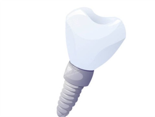 ��ֲ��б��ͼ