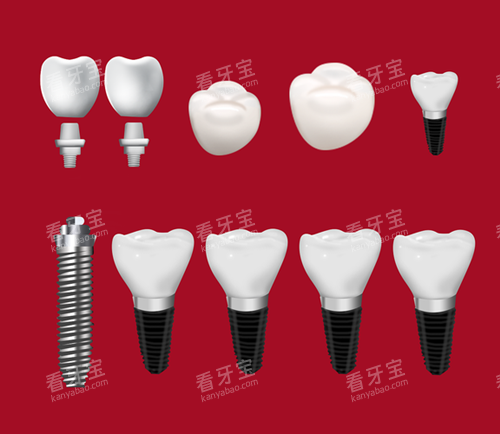 ��ֲ�����