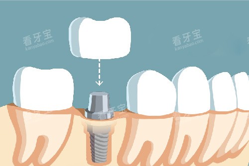 2026���������ǻ�շ���ϸ����¯����ֲ��3200Ԫ��/����98Ԫ��