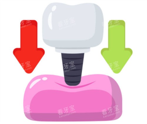 ��ֲ��������ʾ��ͼ