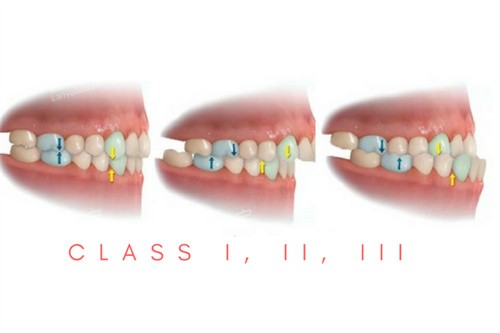 ����һ������