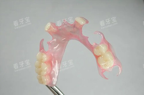 活动义齿实拍示意图 活动义齿实拍示意图