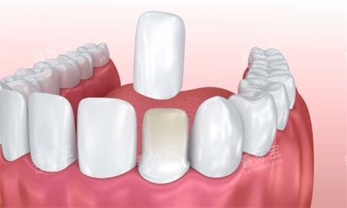 �����涯��չʾͼ