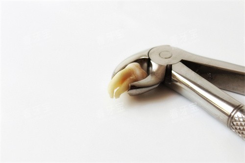 ��������չʾͼ