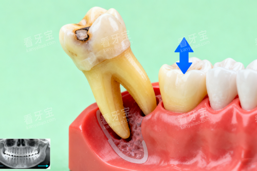 ����Χ�ۣ�����������Ҫ����Ǯһ�ţ���ǰ���۸�100Ԫ�𡢺���300Ԫ���ǳݰγ�400Ԫ��