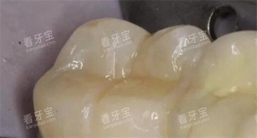 3M��֬����