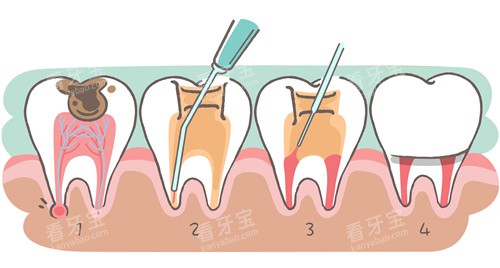 ���ݸ������Ʋ���