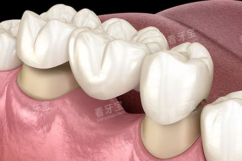 ȫ����������ʾ��ͼ