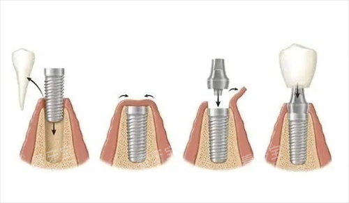 �³�̩��ֲ��