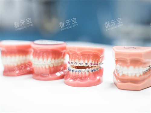 不同的牙齿矫正牙套模型 不同的牙齿矫正牙套模型
