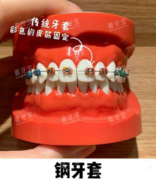 ��ͳ������ͼʾ