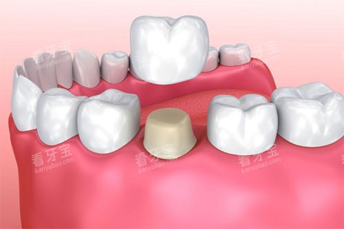 �����������ͼ