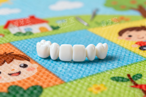 全瓷牙冠模型图 全瓷牙冠模型图