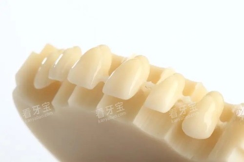 国产美晶瓷全瓷牙展示图 国产美晶瓷全瓷牙展示图