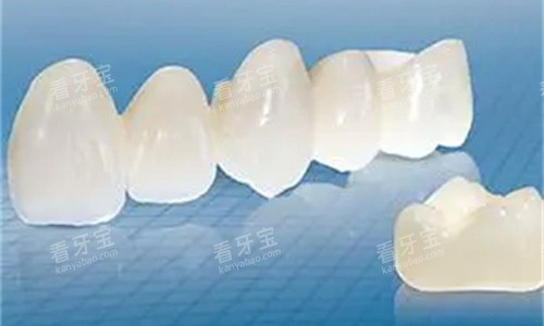 全瓷牙连桥透视图 全瓷牙连桥透视图