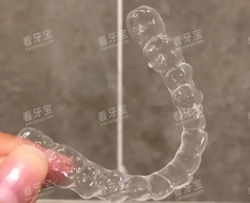 隐形牙齿矫正器 隐形牙齿矫正器