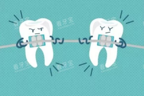 牙齿矫正卡通图 牙齿矫正卡通图