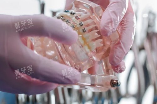 ����ģ�Ͳο�ͼ