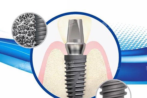 ��ŵ����ֲ��ʾ��ͼ